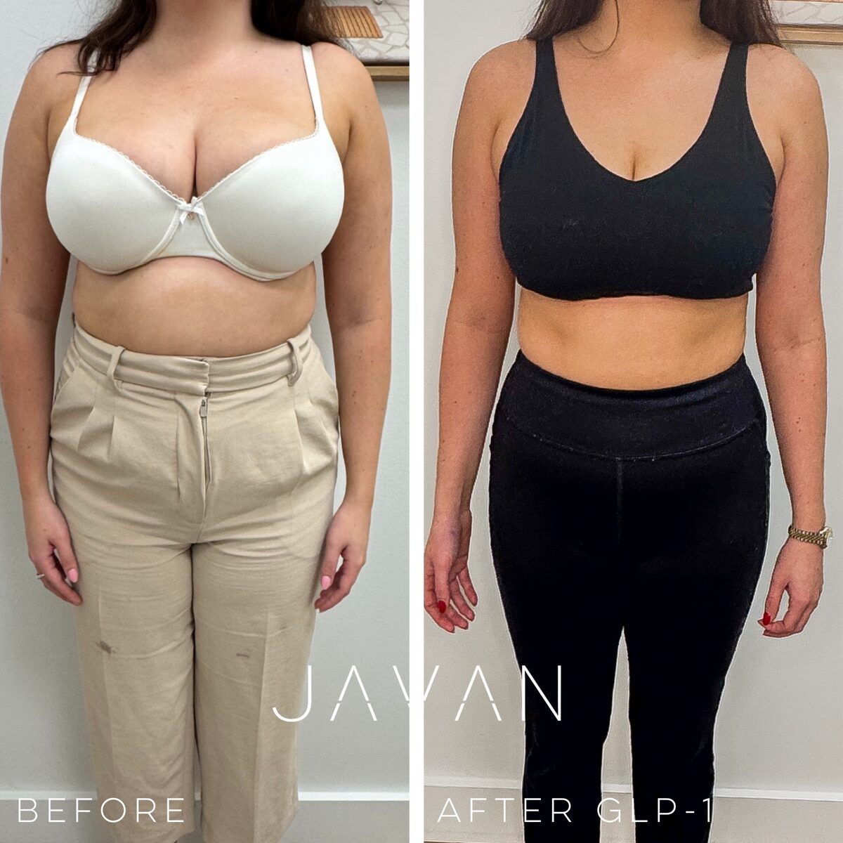 GLP-1 weight loss before and after