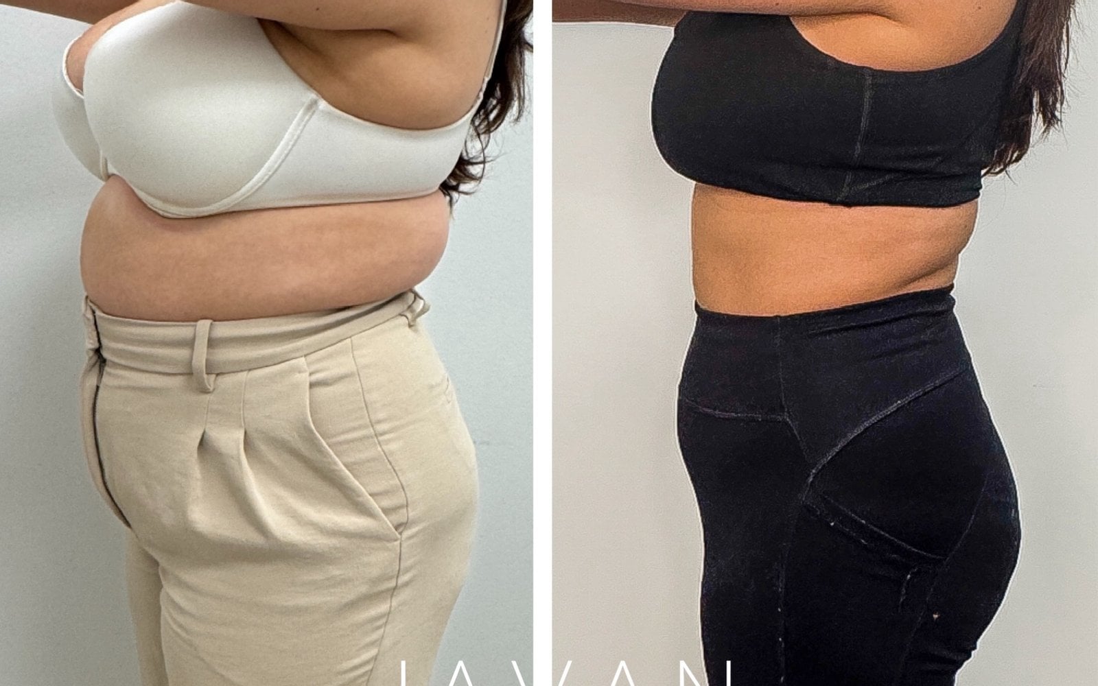 Medical Weight Loss