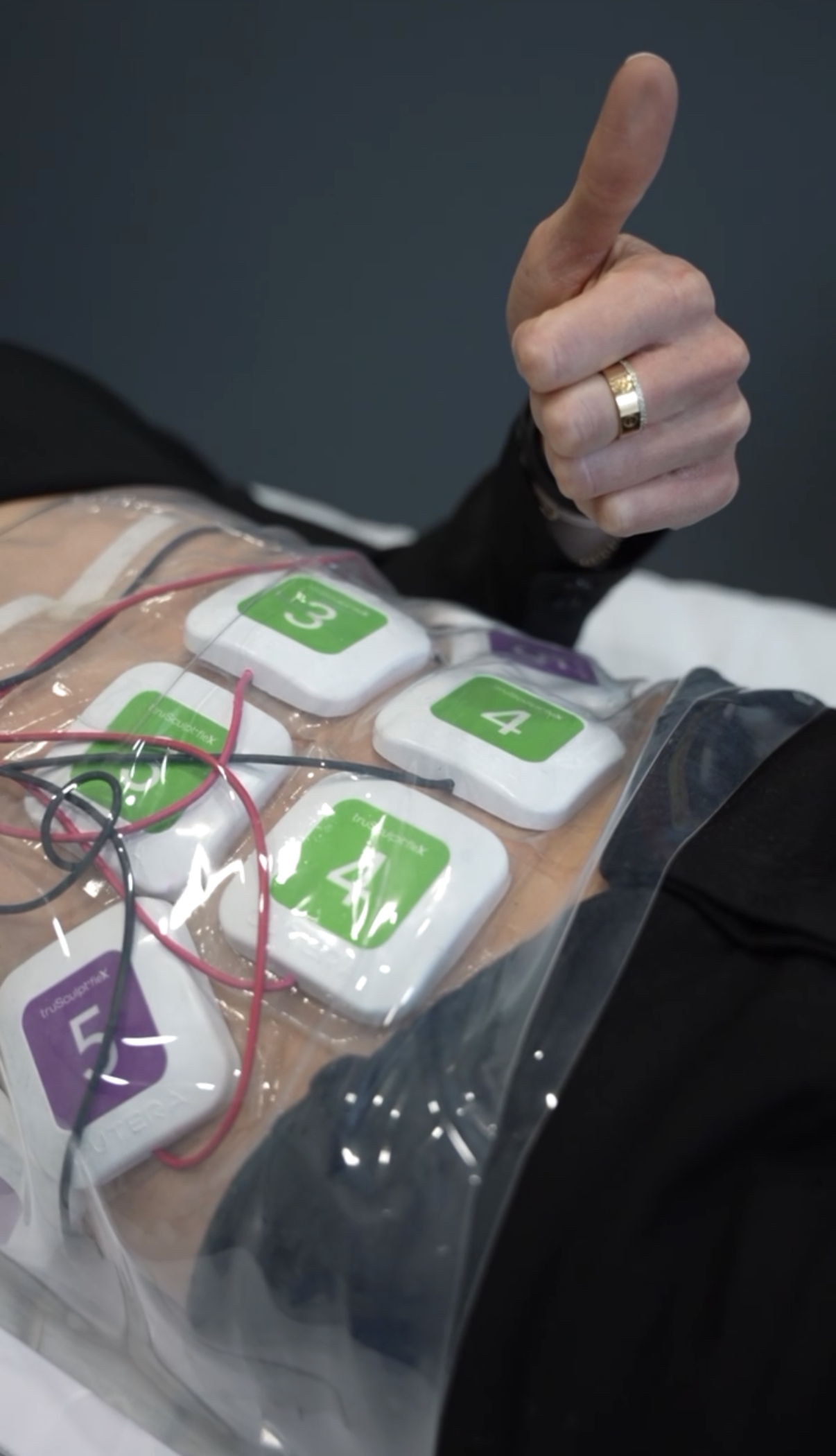Morpheus 8 Body