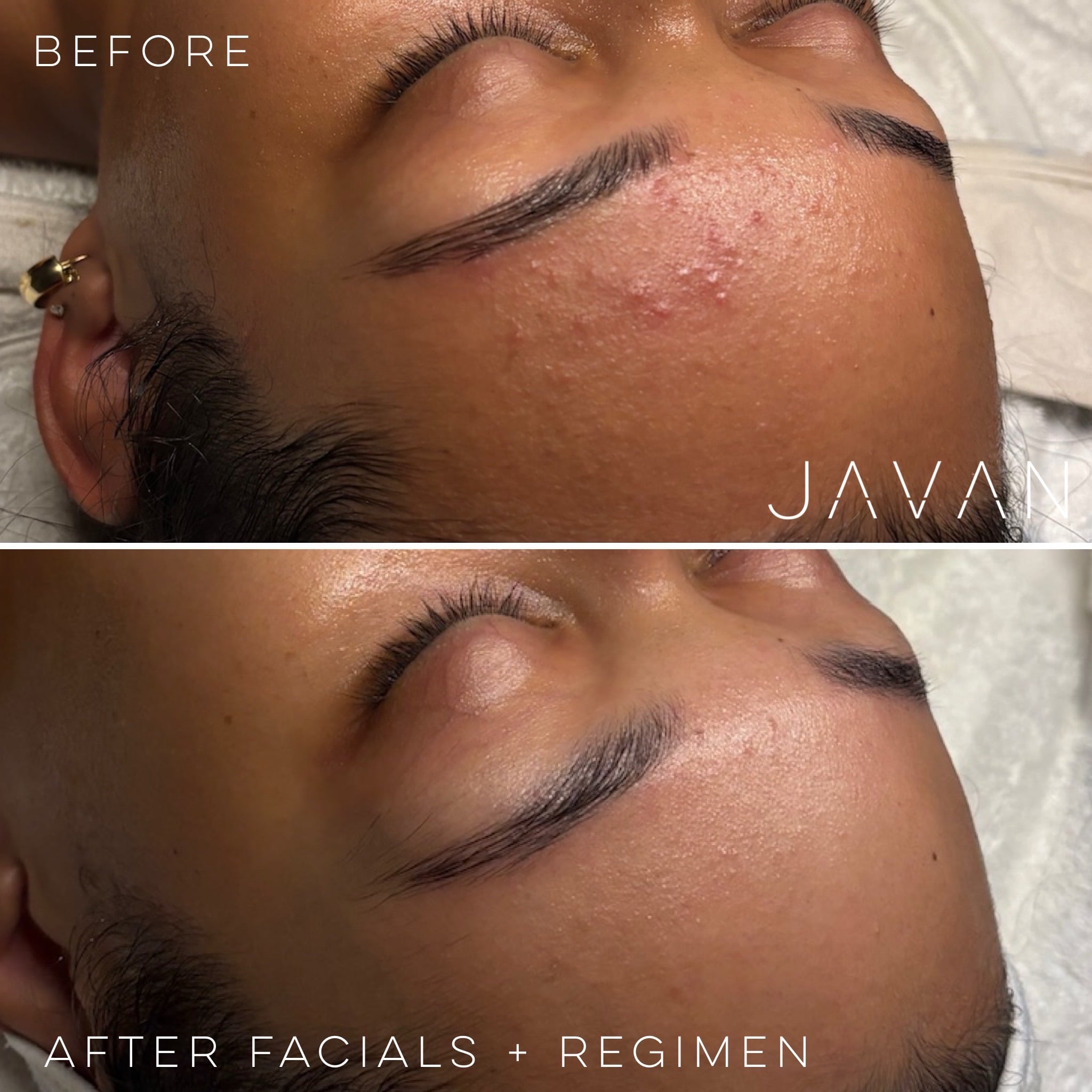 Javan Signature Facials male result
