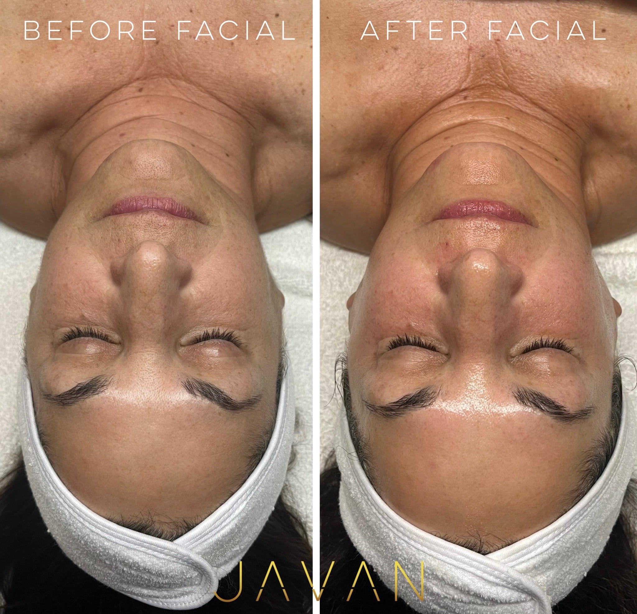 Javan Signature Facials glow result