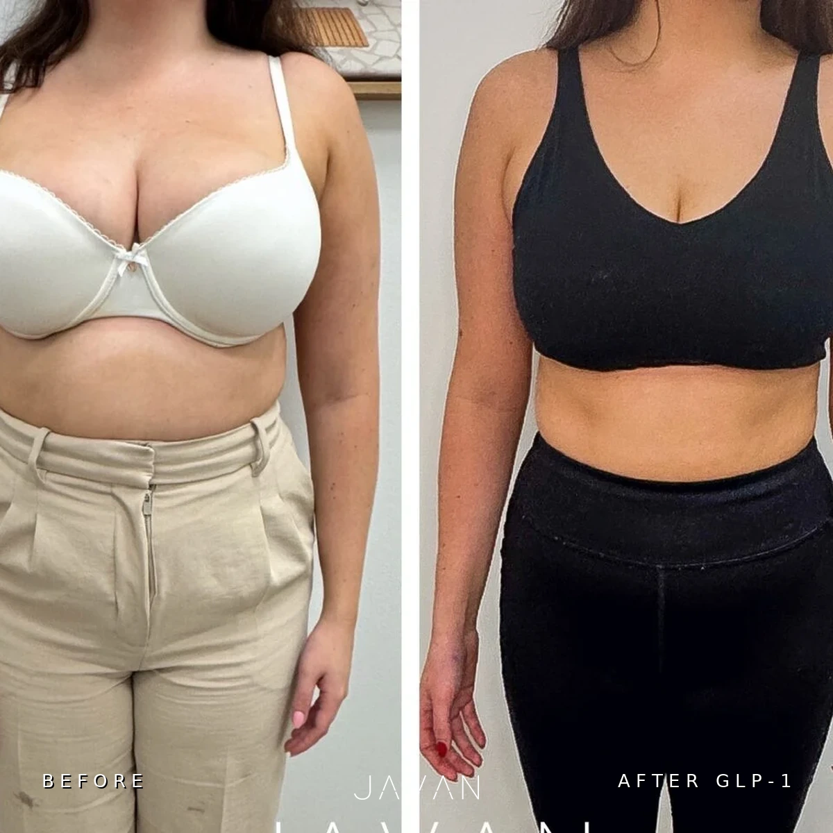 GLP-1 weight loss before and after